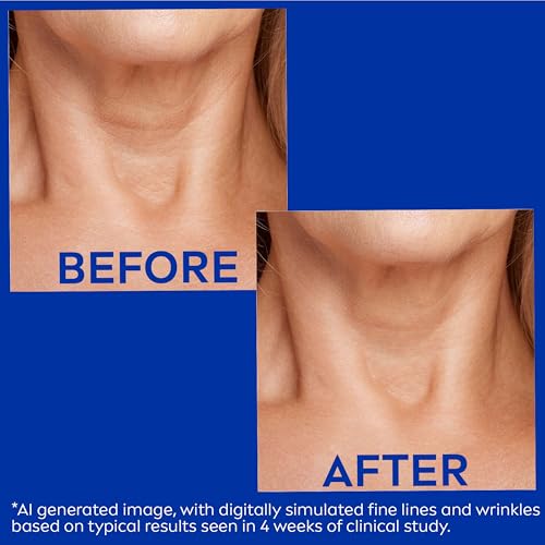 NIVEA Skin Firming & Anti Wrinkle Neck & Chest Cream with Coenzyme Q10,Creatine and Provitamin B5,Skin Firming Cream Reduces the Look of Fine Lines and Wrinkles,6.7 Oz Tube,(Pack of 2)