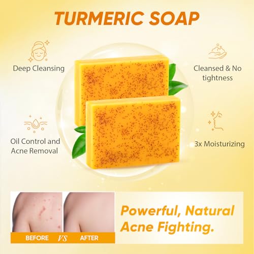 Treeroot 4Pcs Turmeric Face Wash Set: 2Pcs 70g Turmeric Kojic Acid Soap & Turmeric Face Wash with Brush & Turmeric Face Scrub Pads, Face & Body Cleanser, Cleansing Mousse for Deep Cleansing