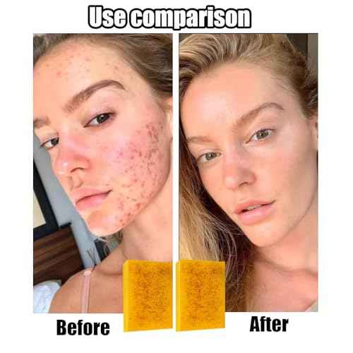 3PCS Lemon Turmeric Kojic Soap + 3 Bubble Nets | Organic Face & Body Bar | Cleansing & Exfoliating | All Skin Types