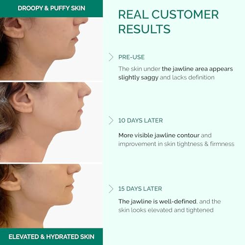 Plantifique V-Line Collagen Mask for face 5 PCS, Chin Strap for Women & Men, V Line Lifting Mask with Collagen and Hyaluronic Acid, V Shape Face Tape Chin and Neck Mask for Skin Firming