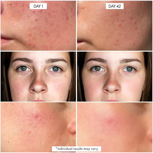 Dr. Crazy Millionaire Glow Vitamin C Serum for Face - Hydrating Glow Up Serum With Turmeric, Niacinamide, Hyaluronic Acid, Snail Mucin & Vitamin E - Fades Dark Spots & Evens Skin Tone ? 30ml