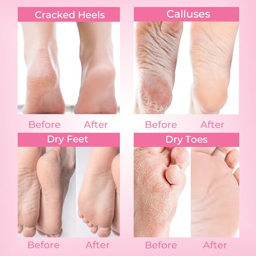 SAISZE Lavender Foot Peeling Mask - 4 Pairs Callus & Dead Skin Remover