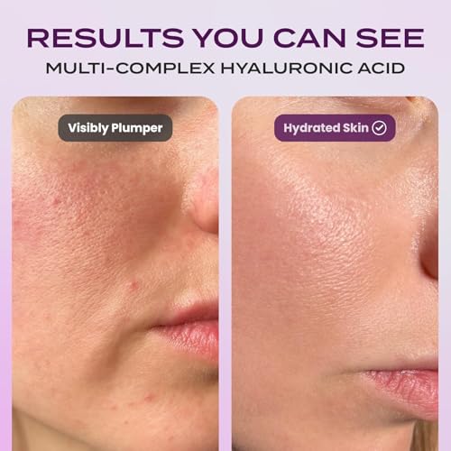 Body Restore Bakuchiol Toner Pads 60 Count ? Gentle Retinol Alternative for Dark Spots & Wrinkles, Korean Skin Care Exfoliating Pads with Niacinamide, Hyaluronic Acid & Bakuchiol Serum, Anti-Aging