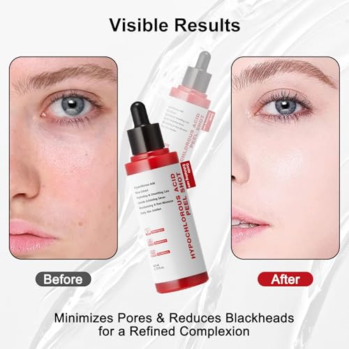 Gentle Exfoliating Serum with Hypochlorous Acid & Rice Extract - Daily Peel Solution for Smooth & Radiant Skin - 80ml