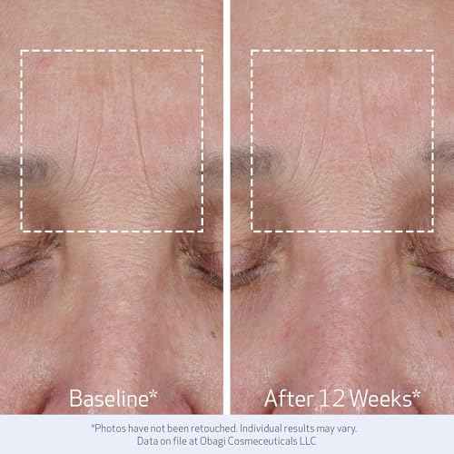 Obagi ELASTIderm Lift Up & Sculpt Facial Moisturizer ? Clinically Proven Anti-Aging Face Cream that Visibly Firms & Sculpts Facial Contours, & Reduces Fine Lines & Wrinkles with Peptides ? 1.7 oz