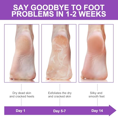Lavender Foot Peeling Mask 5 Pack for Soft, Smooth Feet