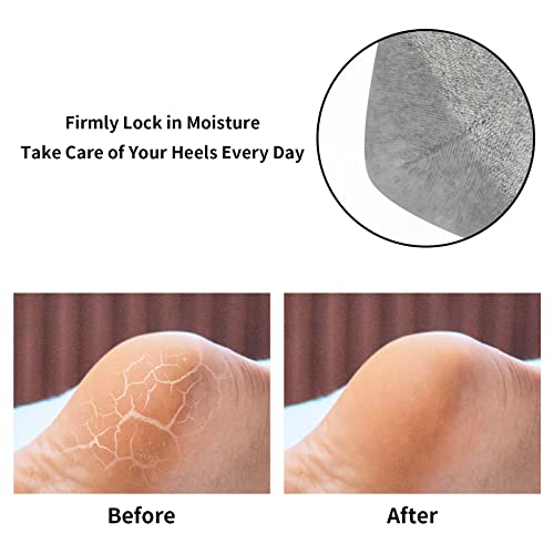 Moisturizing Gel Heel Socks for Dry Cracked Feet, 3 Pack