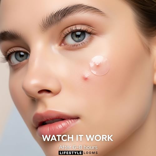 Hydrocolloid Acne Patch with Free Saline Wipe ? Invisible Skin Care Stickers for Face & Acne ? Fast Healing Pimple Patches, Stocking Stuffers for Teen Girls, (RED 72 PATCHES)