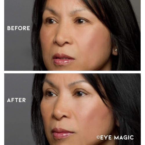 Eye Magic Premium Eye Lift Strips 80 Count Refill Pack - Medium Size, Hypoallergenic, No Gel, Strong Hold, Made in USA