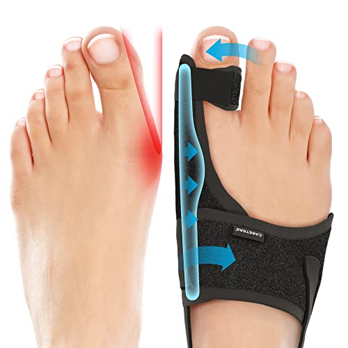 Caretras Bunion Corrector & Toe Straightener for Women & Men - Pain Relief & Comfort