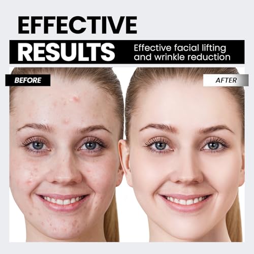 Microcurrent Facial Device with Red Light Therapy - V-Shape Lift