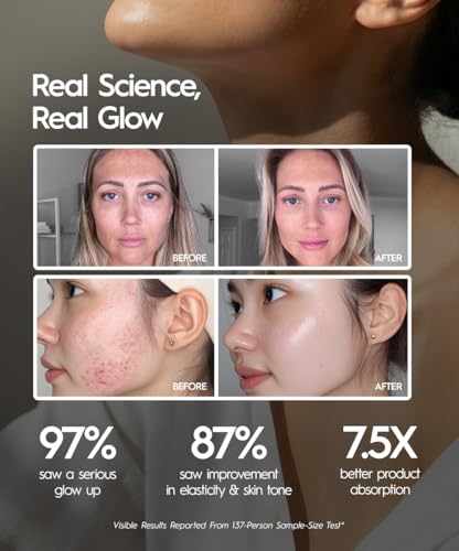 REVO Genie Facial Massager with LED Light Therapy & Heat