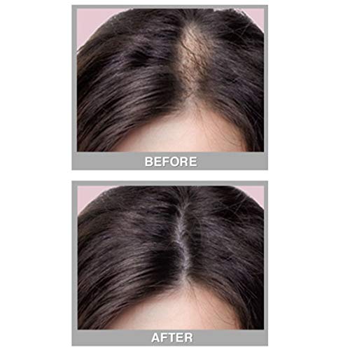 Black Hair Fill In Powder for Thinning & Bald Spots - Pack of 6
