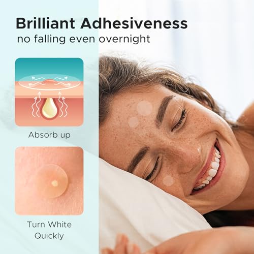 TKTK Pimple Patch Acne Patch, 4 Sizes 280 Patches Acne Absorbing Cover Patch, Hydrocolloid Invisible Acne Patches For Face Zit Patch Acne Dots Tea Tree, Calendula Oil - 2 Pack