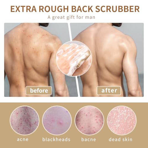 Natural Jute Back Scrubber for Deep Exfoliation & Acne