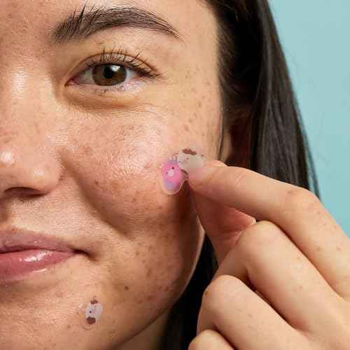 TONYMOLY x Squishmallows Patty + Ronnie Blemish Patches - Niacinamide infused Hydrocolloid pimple patches, 24 Patches