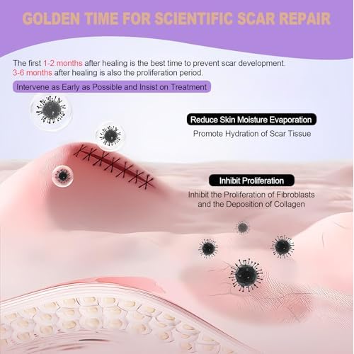 WZPB Silicone Scar Sheets for Scar Removal - Medical Grade Scar Tape for Surgical Scars, C-Section, Keloid, Hypertrophic & Acne Scars | 1.5" x 120" Reusable & Waterproof Scar Strips Roll (2 Pack)