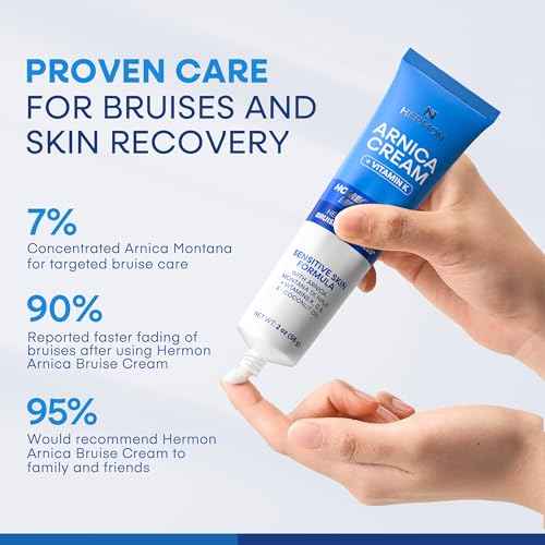 Hermon Arnica Bruise Cream with Vitamin K: Sensitive Skin & Face Formula for Bruising, Swelling & Thin Skin ? Extra Strength Arnica Montana Hydrating Moisturizer 2 Oz