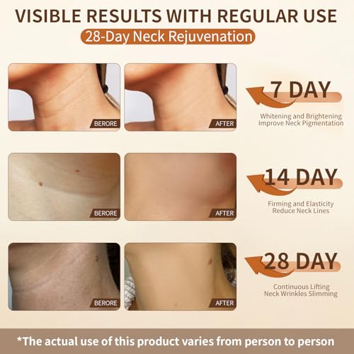 Neck Firming Cream,Tighten and Lift Neck Cream,Neck Tightening Cream Improves Sagging,Skin Tightening and Smooth of Fine Lines