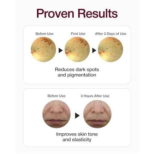 Centellian 24 Expert Madeca Mela Capture Ampoule Max (Madeca Mela 0.5fl oz) High Concentration Serum for Melanin Reduction, Wrinkle & Enhanced Skin Elasticity - TECA Centella Asiatica Extract