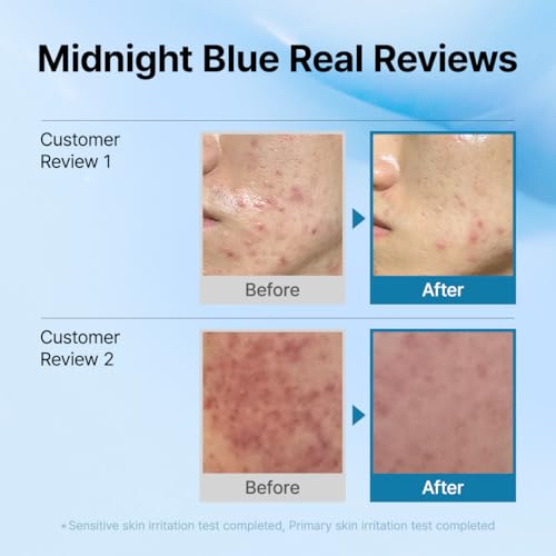 DearKlairs Blue Comforting Duo | Calming&Rich Moist Soothing Creams for Deep Moisture, Korean Skin Care for Dry, Sensitive Skin
