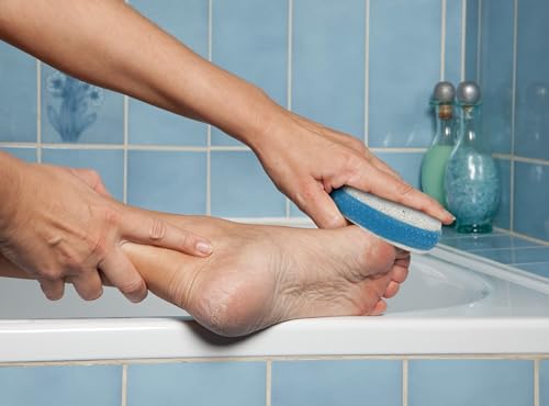 Iconikal Pumice Stone Foot Callus Remover with Non-Slip Rubber Grip, 6-Pack