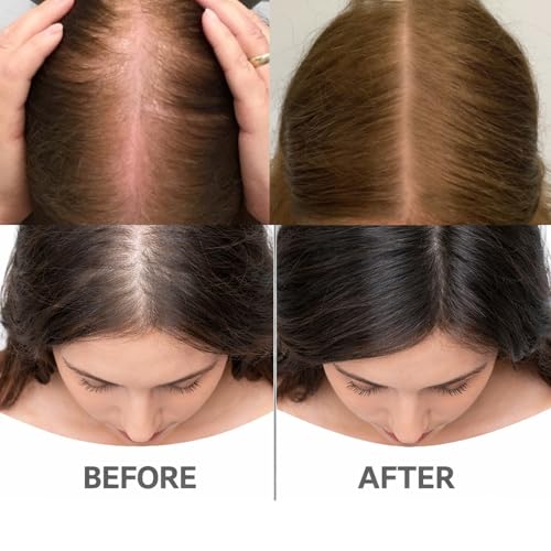 PDRN Hair Ampoule 100ml - Scalp Treatment & Hair Growth (2pcs)