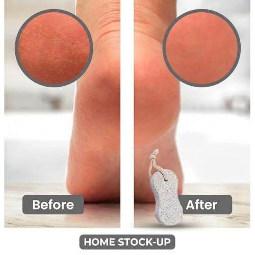 Natural Pumice Stones Pack of 2 for Foot and Hand Exfoliation, Callus Removal
