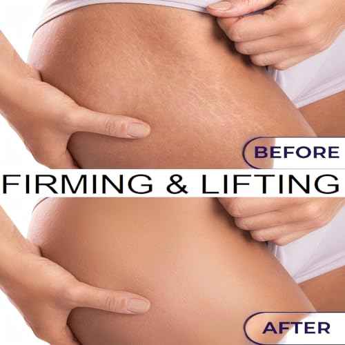 Luxury Body Firming Oil Tightening & Hydrating Treatment After Shower Body Oil For Women | Natural Body Luxury Oil for Dry Skin | Lightweight, Non-Greasy, Nourishing Formula ? 4.06 FL OZ