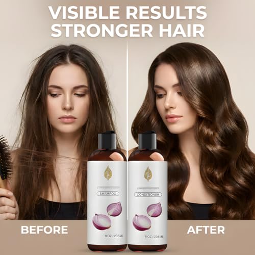 Onion Shampoo & Conditioner Set with Biotin & Rosemary - 8oz