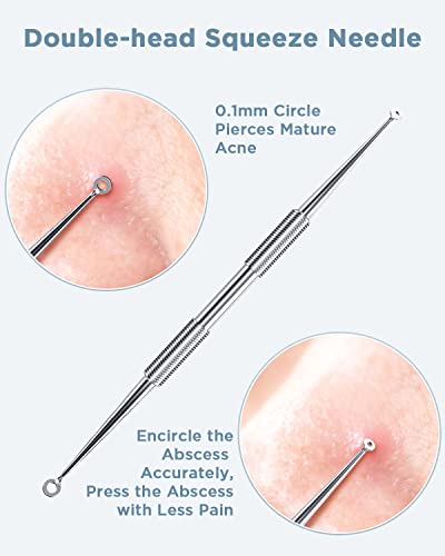 Blackhead Remover Tool Kit, 5-Piece Pimple Extractor Set
