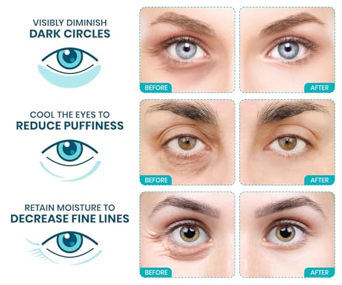 Stylia Collagen & Vitamin C Under Eye Patches for Puffy Eyes Dark