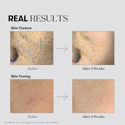 VT COSMETICS TX Toning Essence 1000 Shot, Tranexamic Acid Serum with Niacinamide, Glutathione for Radiant Glass Skin Face, Dark Spots, Sun Spots, Age Spots, Acne Scar, Korean Skin Care (1.01 fl. oz.)