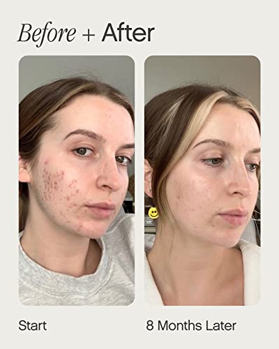 Topicals Faded Brightening Serum - Dark Spot & Scar Reducer