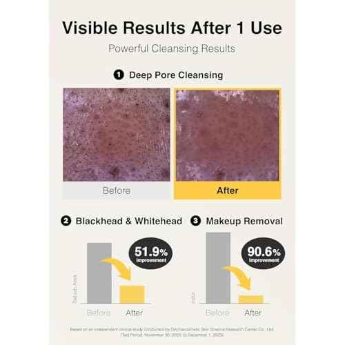 MISSHA Vita C All-In-One Bubble Foam Facial Cleanser 6.76 Fl oz / 200ml- Deep Pore Detox, Magic Bubbles with 99% Pure Vitamin C, Korean Face Wash - Removes Impurities, Makeup, Blackheads, Whiteheads