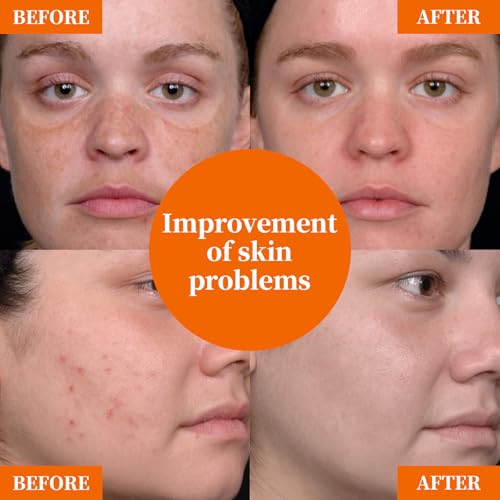 Vitamin C Facial Serum 20% with Hyaluronic Acid & Niacinamide ? Anti-Aging Formula to Boost Collagen, Hydrate and Plump Skin, For All Skin Types ? 1 Fl Oz
