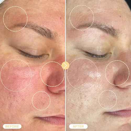 BASE LABORATORIES Hypochlorous Acid Spray for Face & Skin - Travel Size - Facial Toner Spray & Cleaner - Skin Repair Solution helps reduce redness, Irritations, acne - HOCL Molecule Spray 2oz