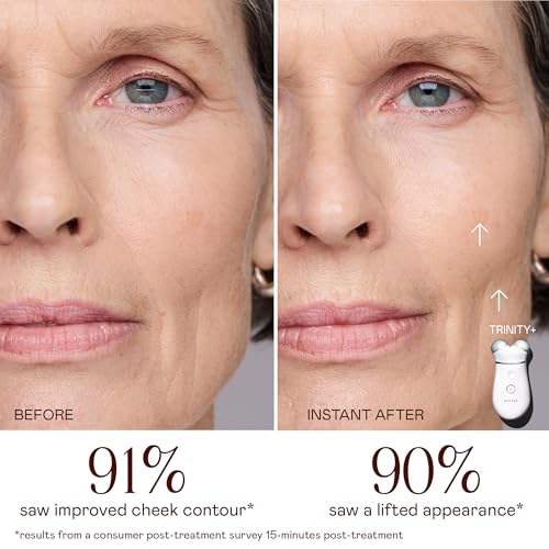 NuFACE Trinity+ Microcurrent Face Lift Device with Activator Gel