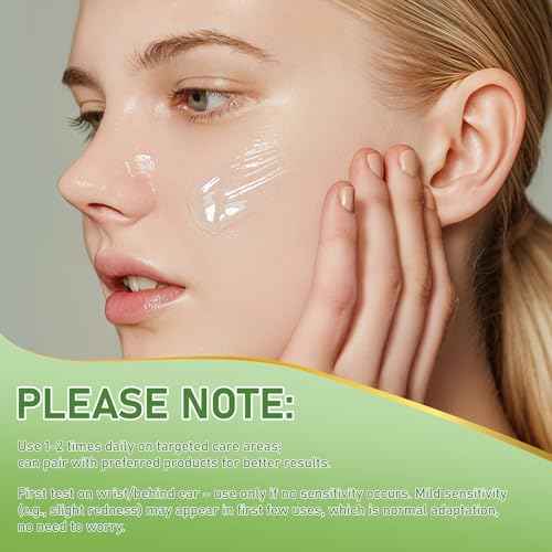 14% Azelaic Acid Acne Cream, Azelaic Acid For Face, Helps Improve the Appearance of Acnes - Azalecic Acids Acido Azelaico, 1 Fl Oz