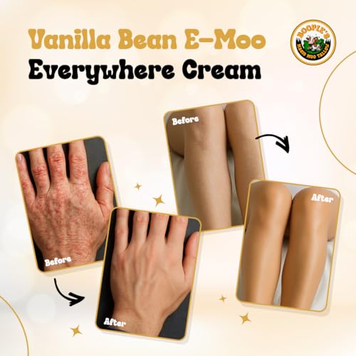 Magic Moo Beef Tallow Vanilla Bean E-Moo Moisturizing Everywhere Suet Tallow Cream with Organic Emu Oil. For Acne, Stretch Marks, Eczema, Hydration, Dry Skin & More! 8oz