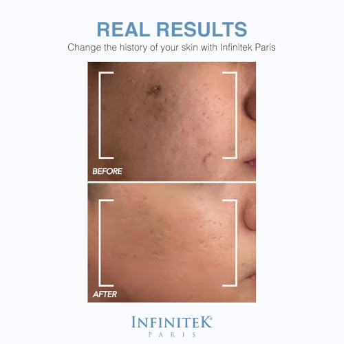 Infinitek Paris | Hyaluronic Acid Serum | Galentine¡¯s Gifts & Valentine¡¯s Day Gifts for Women | Facial Skin Care - Hydrating Hyaluronic Acid Face Serum with Organic Silicon | 1 fl oz / 30 ml