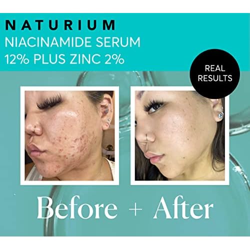 Naturium Niacinamide Face Serum 12% Plus Zinc 2%, Anti-Aging, Pore Minimizer & Dark Spot Corrector with Hyaluronic Acid & Vitamin E, Vegan & Cruelty-Free, 1 oz
