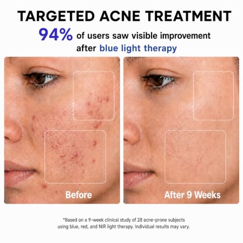Red Light Therapy LED Face Mask for Acne & Fine Lines