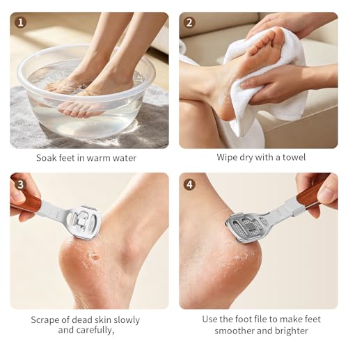 ZIZZON Callus Shaver for Feet - Wood Handle Pedicure Tool with 10 Blades
