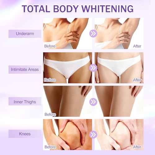 Skin Bleaching Cream, Dark Spot Remover for Body and Face, Contains Vitamin C, Mild and Non-irritating, Suitable for Underarms, knees, Elbows, Inner Thighs, and Bikini Line 1.7 Fl Oz (Pack of 1)