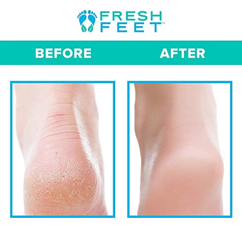 Fresh Feet- Foot Scrubber With Pumice Stone, Cleans, Smooths, Exfoliates & Massages your Feet Without Bending in the Shower or Bathtub