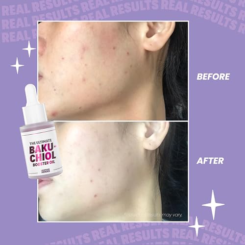Handmade Heroes 2% Bakuchiol Oil with Sugarcane Squalane, All Natural Retinol Alternative Facial Oil For Radiant and Line Smoothing, Travel size skincare 0.3 fl oz