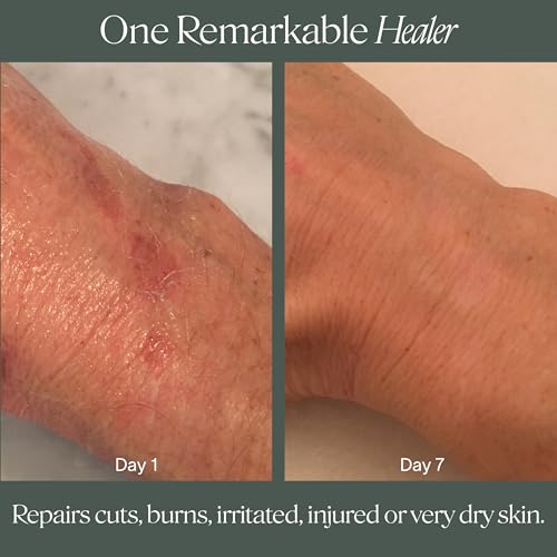 Doctor Rogers Restore Healing Balm. Multi-Purpose Healing Ointment & Moisturizing Relief Gel. Protects & Soothes Injured, Sensitive & Dry Skin, 1 Ounce (28 g) Jar