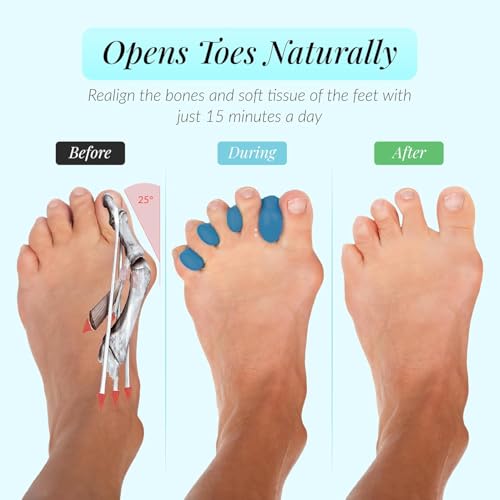 JoyaToes Toe Separators Small - Soft Gel Spacers for Yoga & Recovery