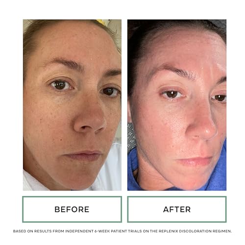 Replenix Glycolic Acid Resurfacing Skin Peel, Medical-Grade Facial Peeling Pads for Discoloration & Acne (60 ct.)